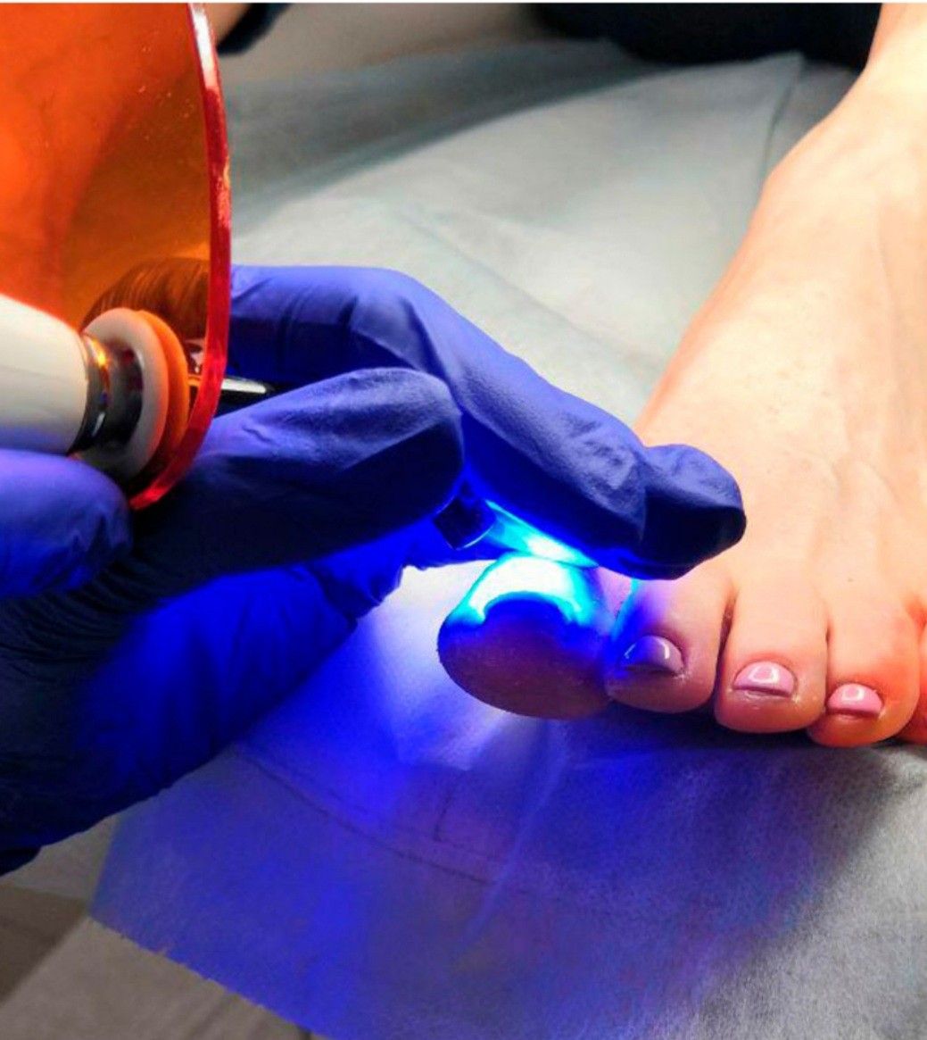 Pedicure Clínico en Medellín - DALIA OSORIO Belén